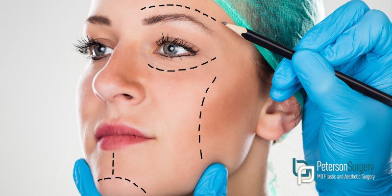 How Modern Techniques Create Natural Results – Kelowna Facial Surgery
